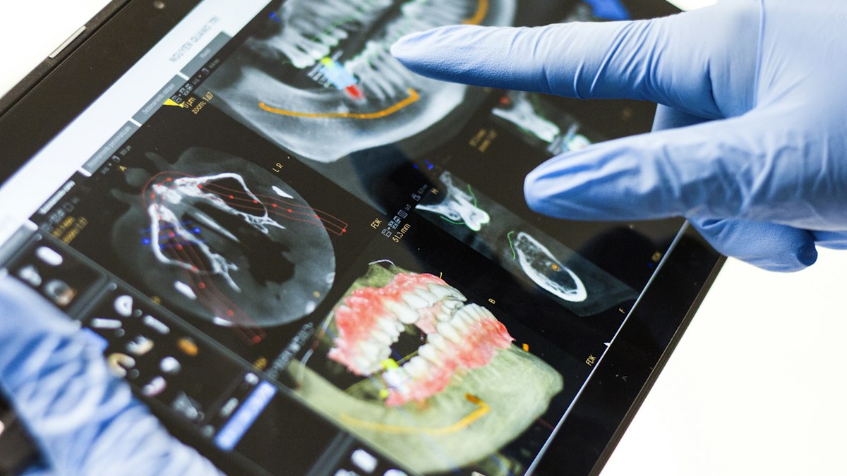 Clinician reviewing a smile and jaw scan on a tablet during cosmetic planning